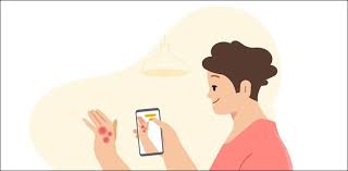 Will Google help diagnose skin diseases?